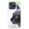 Coque souple en silicone Huawei Honor 400 lite à personnaliser